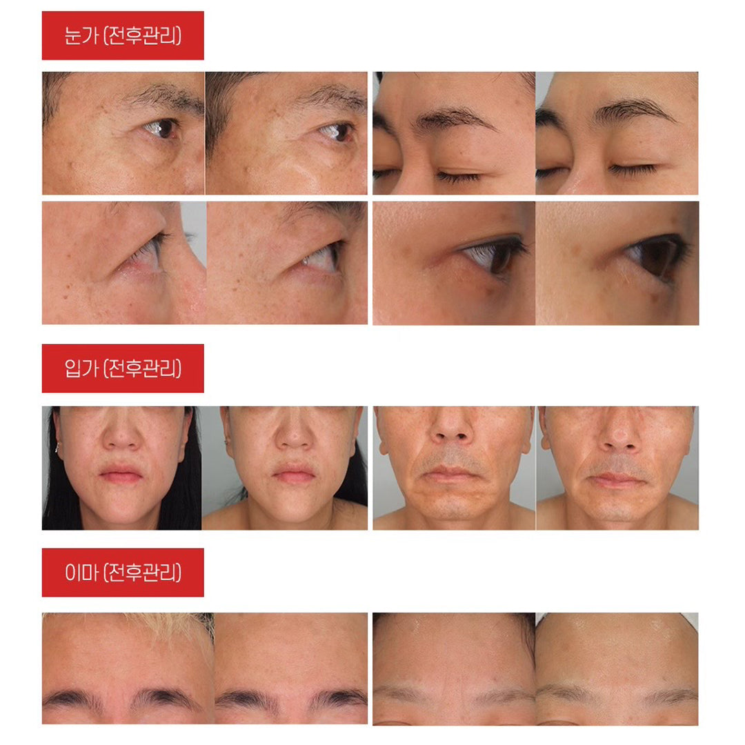 Pamsibc Skinalle No Gravity Lifting Mask - 6 Sheets